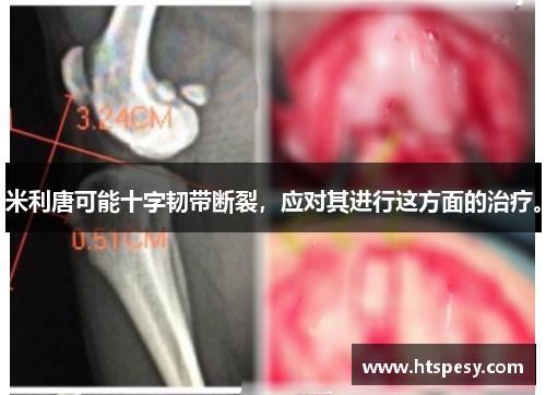 米利唐可能十字韧带断裂，应对其进行这方面的治疗。